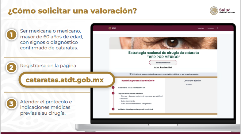 “Ver por México” Gobierno de México ofrece cirugías de catarata gratuitas